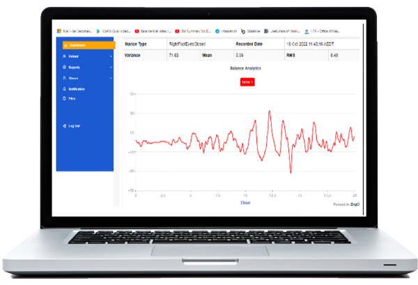 Right foot eyes open Balance Mat graph on a laptop computer Right foot eyes open Balance Mat graph on a laptop computer