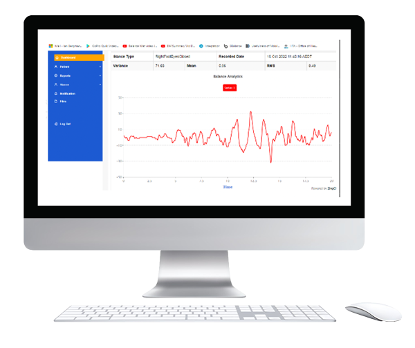 Right foot eyes open Balance Mat graph on a desktop computer Right foot eyes open Balance Mat graph on a desktop computer